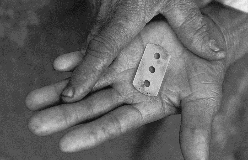 Das Foto zeigt eine Rasierklinge auf einer geöffneten Handfläche. (Quelle: Kindernothilfe)